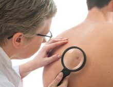 How Pain and Itching Signal Skin Cancer