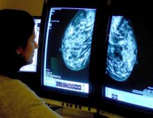 Women’s Access to Cancer Screenings